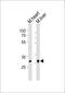 Homeobox B1 antibody, M04724, Boster Biological Technology, Western Blot image 