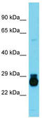 Homeobox C6 antibody, TA329236, Origene, Western Blot image 