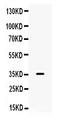 Gal-9 antibody, PB9660, Boster Biological Technology, Western Blot image 