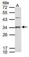 R-Spondin 1 antibody, PA5-34937, Invitrogen Antibodies, Western Blot image 