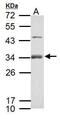 R-spondin-1 antibody, PA5-34937, Invitrogen Antibodies, Western Blot image 