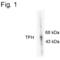 Tryptophan Hydroxylase 1 antibody, PA1-4644, Invitrogen Antibodies, Western Blot image 