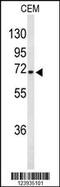 Gamma-Aminobutyric Acid Type A Receptor Alpha4 Subunit antibody, 63-880, ProSci, Western Blot image 