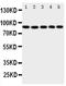 Arachidonate 5-Lipoxygenase antibody, PA1644, Boster Biological Technology, Western Blot image 
