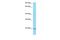 KRAS Proto-Oncogene, GTPase antibody, PA5-70104, Invitrogen Antibodies, Western Blot image 