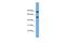 Raftlin Family Member 2 antibody, A17009, Boster Biological Technology, Western Blot image 