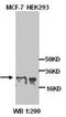 Protein Kinase AMP-Activated Non-Catalytic Subunit Beta 1 antibody, orb77067, Biorbyt, Western Blot image 