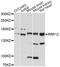 Ribosomal RNA Processing 12 Homolog antibody, LS-C748314, Lifespan Biosciences, Western Blot image 