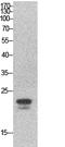 Sex Determining Region Y antibody, STJ96862, St John