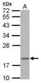 Ring Finger Protein 181 antibody, GTX117747, GeneTex, Western Blot image 