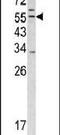 Transmembrane Serine Protease 2 antibody, PA5-14265, Invitrogen Antibodies, Western Blot image 