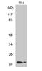 p21 antibody, A00145T145-1, Boster Biological Technology, Western Blot image 