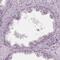 ADP-Ribosylhydrolase Like 1 antibody, PA5-64278, Invitrogen Antibodies, Immunohistochemistry frozen image 