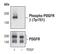 Platelet Derived Growth Factor Receptor Beta antibody, MA5-14823, Invitrogen Antibodies, Western Blot image 