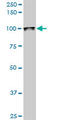 Autoantigen NOR-90 antibody, LS-B6166, Lifespan Biosciences, Western Blot image 