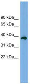 Death Effector Domain Containing 2 antibody, TA340269, Origene, Western Blot image 