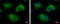 Ubiquitin Conjugating Enzyme E2 R2 antibody, GTX117722, GeneTex, Immunocytochemistry image 