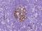 Ribonucleotide Reductase Regulatory Subunit M2 antibody, GTX02222, GeneTex, Immunohistochemistry paraffin image 