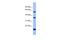 La Ribonucleoprotein Domain Family Member 6 antibody, A08524, Boster Biological Technology, Western Blot image 