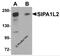 Signal Induced Proliferation Associated 1 Like 2 antibody, 5493, ProSci, Western Blot image 