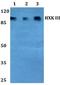 Hexokinase 3 antibody, A05145-1, Boster Biological Technology, Western Blot image 