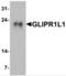 GLIPR1 Like 1 antibody, NBP2-81989, Novus Biologicals, Western Blot image 