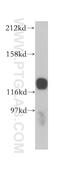 Heterogeneous Nuclear Ribonucleoprotein U antibody, 14599-1-AP, Proteintech Group, Western Blot image 