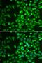 Lecithin retinol acyltransferase antibody, LS-C334848, Lifespan Biosciences, Immunofluorescence image 