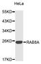 RAB8A, Member RAS Oncogene Family antibody, STJ25268, St John