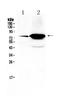 Follicle Stimulating Hormone Receptor antibody, A00897, Boster Biological Technology, Western Blot image 