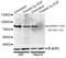 Insulin Receptor antibody, AP0044, ABclonal Technology, Western Blot image 