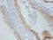 TIMP Metallopeptidase Inhibitor 1 antibody, LS-C212354, Lifespan Biosciences, Immunohistochemistry paraffin image 