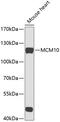 Minichromosome Maintenance 10 Replication Initiation Factor antibody, 19-656, ProSci, Western Blot image 
