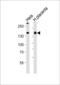 Collagen Type IV Alpha 1 Chain antibody, 62-860, ProSci, Western Blot image 