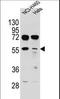 TSPY Like 6 antibody, LS-C160278, Lifespan Biosciences, Western Blot image 