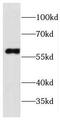 CPN3 antibody, FNab01928, FineTest, Western Blot image 