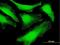 Syndecan Binding Protein antibody, H00006386-B01P, Novus Biologicals, Immunocytochemistry image 