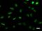 Damage Specific DNA Binding Protein 2 antibody, LS-C342450, Lifespan Biosciences, Immunofluorescence image 