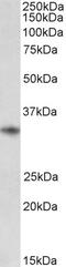 Musashi RNA Binding Protein 2 antibody, 43-615, ProSci, Enzyme Linked Immunosorbent Assay image 
