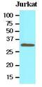 Toll Interacting Protein antibody, GTX53793, GeneTex, Western Blot image 