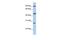 Centromere Protein I antibody, GTX45379, GeneTex, Western Blot image 