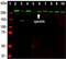 Spectrin Alpha, Non-Erythrocytic 1 antibody, NBP1-92689, Novus Biologicals, Western Blot image 