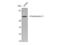 Keratin 5 antibody, STJ92636, St John