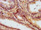 Caseinolytic Mitochondrial Matrix Peptidase Proteolytic Subunit antibody, LS-C671043, Lifespan Biosciences, Immunohistochemistry paraffin image 