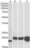 Superoxide Dismutase 1 antibody, STJ70903, St John