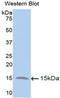 Trefoil Factor 2 antibody, LS-C300609, Lifespan Biosciences, Western Blot image 