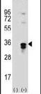 Palmitoyl-Protein Thioesterase 1 antibody, PA5-12229, Invitrogen Antibodies, Western Blot image 