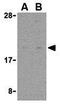 Ras Homolog, MTORC1 Binding antibody, GTX31712, GeneTex, Western Blot image 