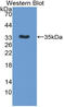 Interleukin 12B antibody, LS-C314358, Lifespan Biosciences, Western Blot image 