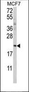 Splicing Factor 3b Subunit 2 antibody, orb247263, Biorbyt, Western Blot image 
